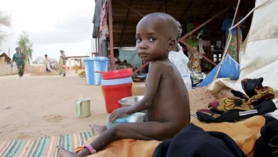 Un niño malnutrido en la clínica de Médicos sin Fronteras en Maradi, Níger, en una imagen de archivo. EFE/Str